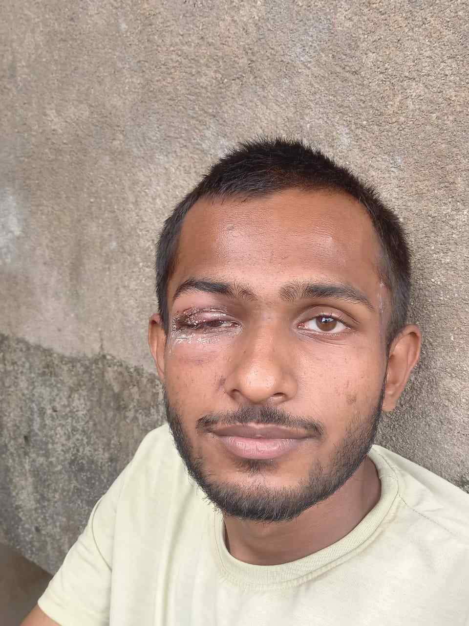 वीडियो: अकेले युवक की मंगला रोड के अंधेरे में जमकर कुटाई, रुद्र शुक्ला और उसके अन्य साथियों के खिलाफ जुर्म दर्ज.