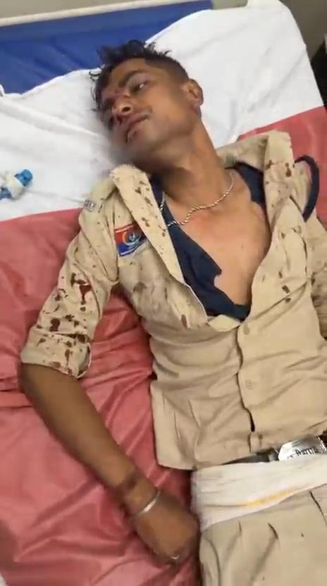 'OMG' ब्रेकिंग,खाकी पर खूनी वार: डायल-112 के आरक्षक को डंडा मारकर किया लहूलुहान.